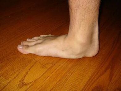 Dangers of deformation
