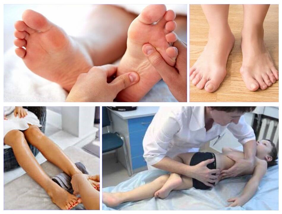 Valgus deformation on children's treatment