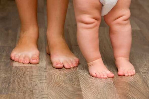 Valgus deformation on children