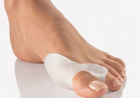 Silicone locks for the toes