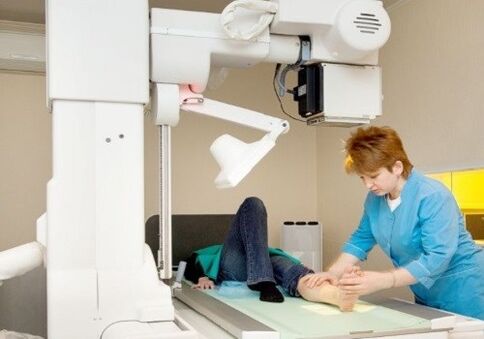 X -ray leg